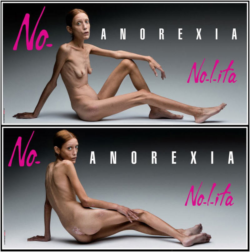 Illustration for article titled Isabelle Caro, Anorexic Model, Dead At 28